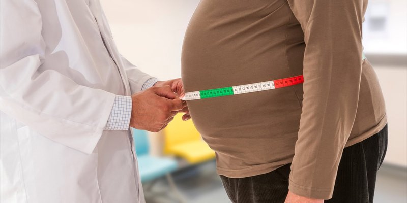 Obesità addominale: nuovo studio mette in luce il legame con le migreni